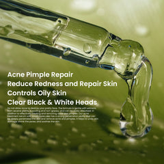 Face Serum - Acne Treatment (30ml)